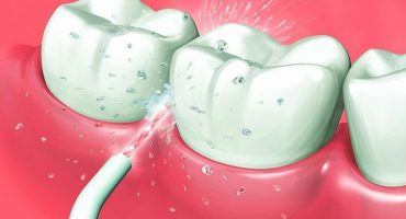 Oral irrigator - som er bedre å velge og hvorfor du trenger det