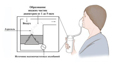 Inhalatora lietošanas noteikumi: kā tas darbojas un kāpēc?